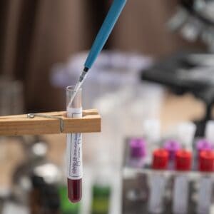 doctor working with blood sample in laboratory