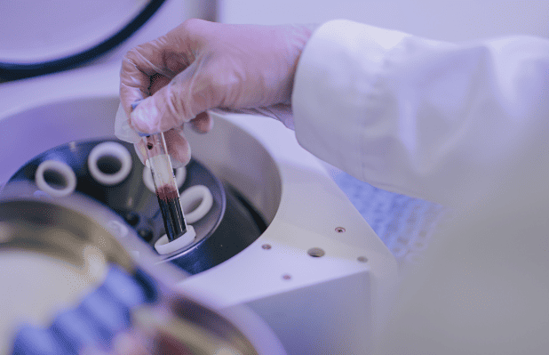 PRP Therapy