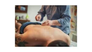Acupuncture