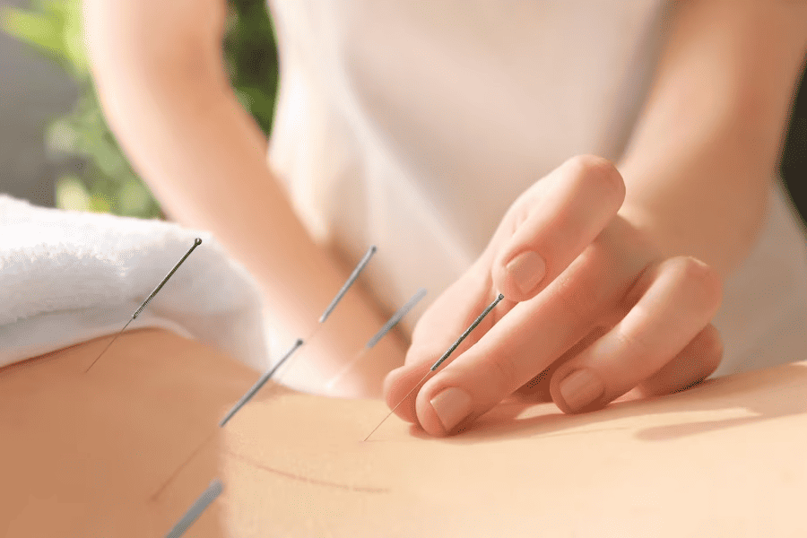Relieve Pain with Acupuncture
