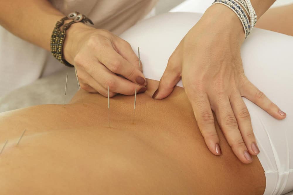 Acupuncture Encinitas