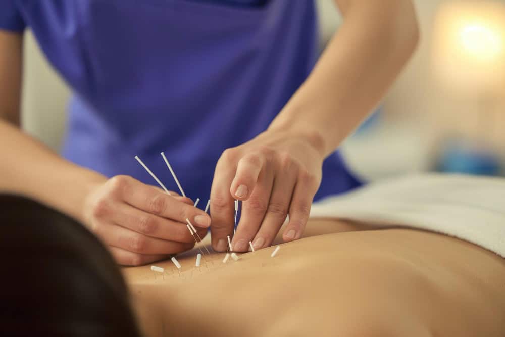 Acupuncture Encinitas
