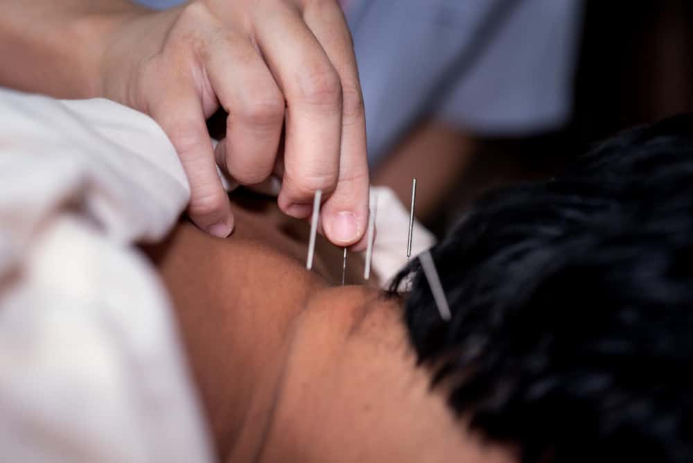 Acupuncture Poway
