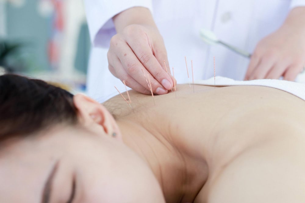 Discover Healing with Acupuncture Encinitas Care