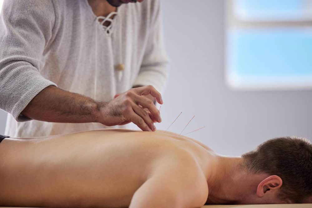 Acupuncture Poway