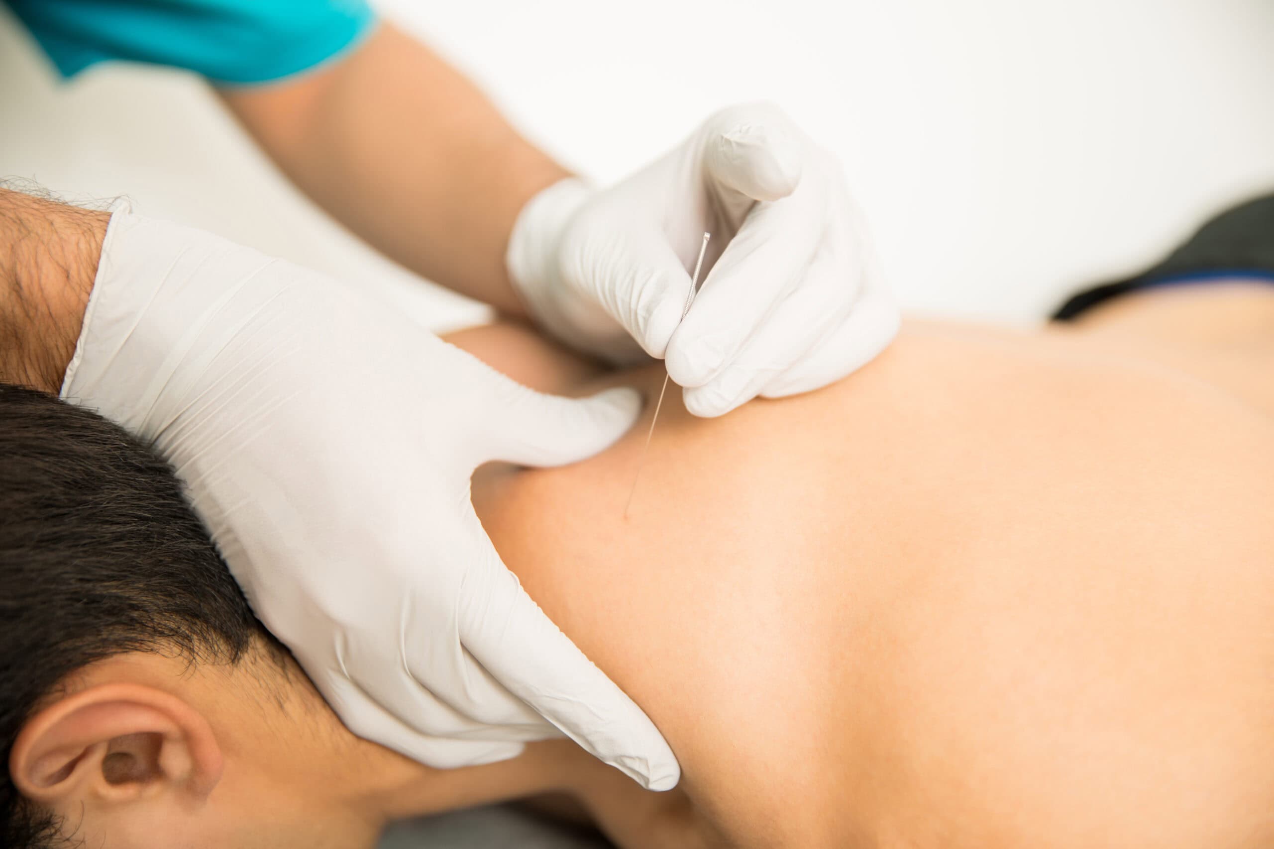 Acupuncture Poway Care