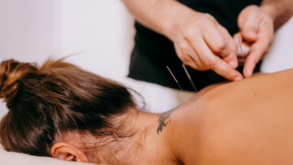 Acupuncture Poway