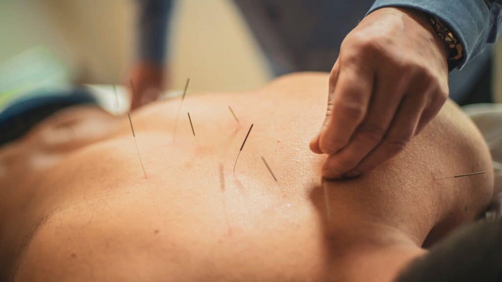 Acupuncture Encinitas