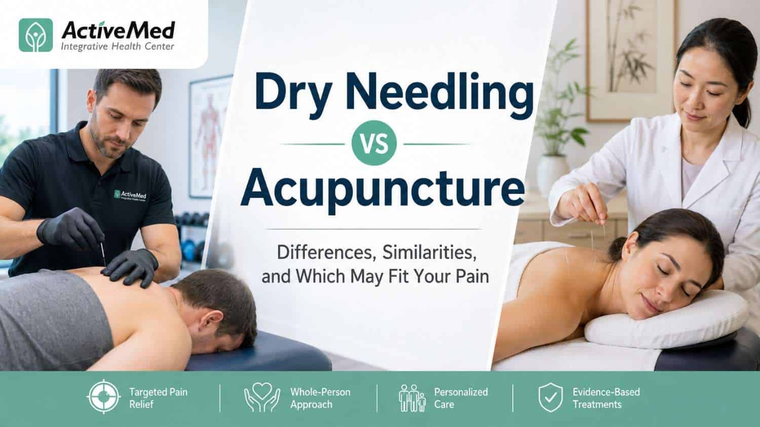 Dry Needling vs Acupuncture: Differences, Similarities, and Which May Fit Your Pain