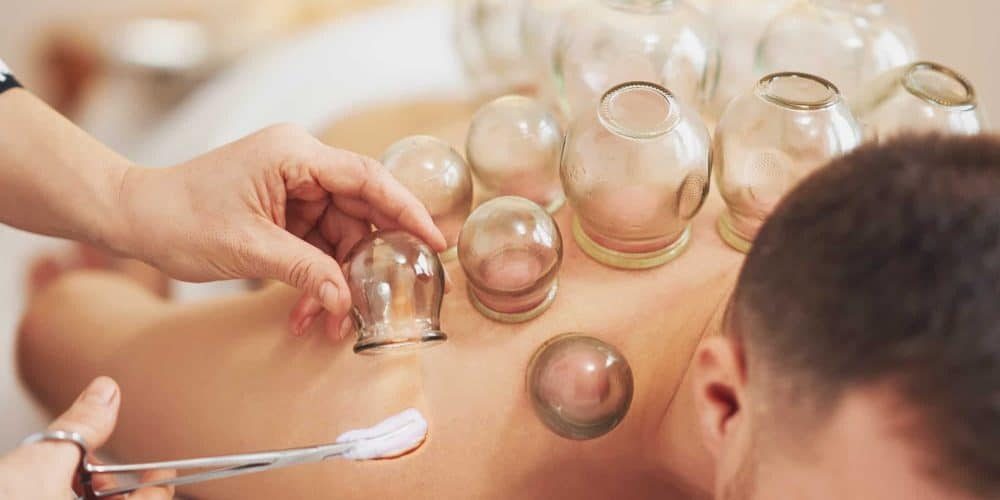Cupping in Encinitas, Poway and Encinitas
